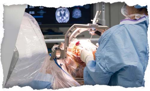 Neurosurgeons performing a brain or spinal surgery procedure in an advanced operating room.