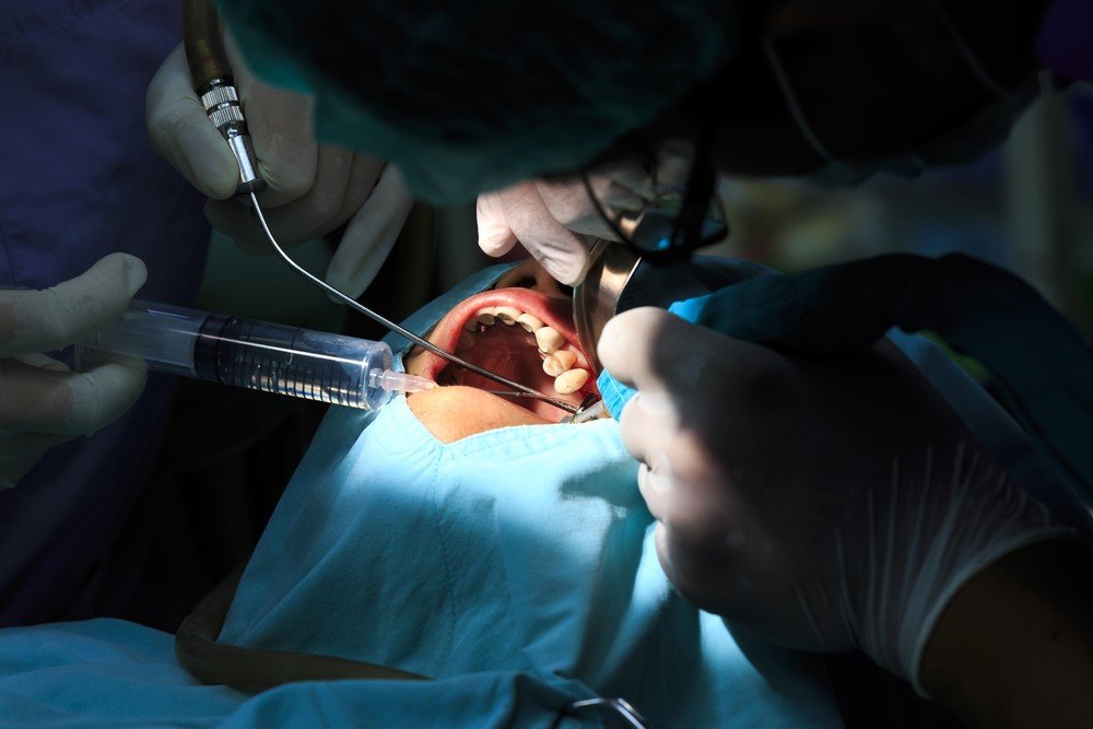 Dentist performing an oral surgery procedure using medical instruments and suction equipment inside a patient’s mouth.
