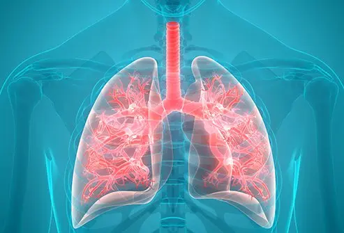 Medical illustration of human lungs and respiratory system showing the bronchial network and airways.