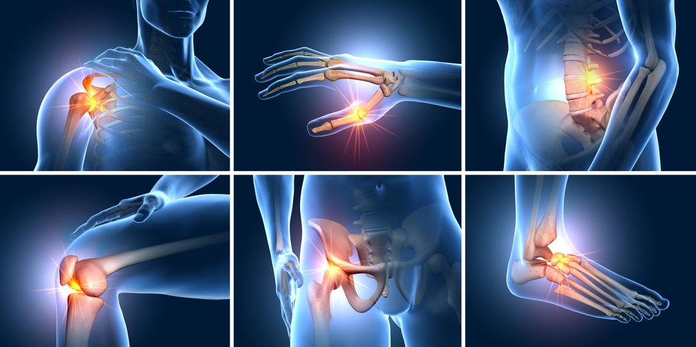 Medical illustration highlighting common joint pain areas including the shoulder, wrist, spine, knee, hip, and ankle.